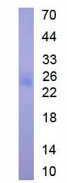 Active Ciliary Neurotrophic Factor (CNTF)