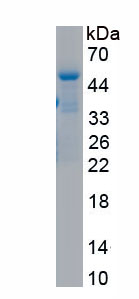 Active Endothelial protein C receptor (EPCR)