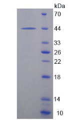 Active Endocrine Gland Derived Vascular Endothelial Growth Factor (EG-VEGF)