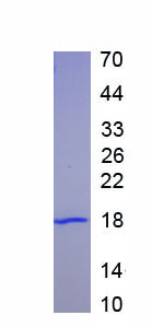 Active Factor Related Apoptosis (FAS)