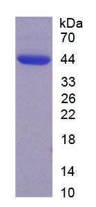 Active Chemokine C-X3-C-Motif Ligand 1 (CX3CL1)