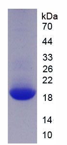 Active Glial Cell Line Derived Neurotrophic Factor (GDNF)