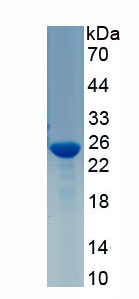 Active Growth Hormone (GH)