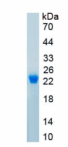 Active Growth Hormone (GH)