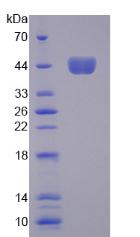 Active Colony Stimulating Factor 2, Granulocyte Macrophage (GM-CSF)