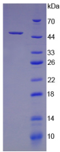 Active Colony Stimulating Factor 2, Granulocyte Macrophage (GM-CSF)