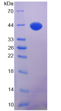 Active Insulin Like Growth Factor 1 (IGF1)