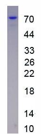 Active Insulin Like Growth Factor Binding Protein 2 (IGFBP2)