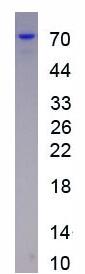 Active Insulin Like Growth Factor Binding Protein 2 (IGFBP2)