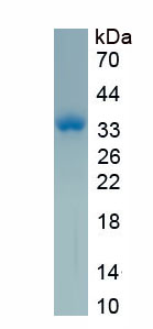Active Insulin Like Growth Factor Binding Protein 2 (IGFBP2)