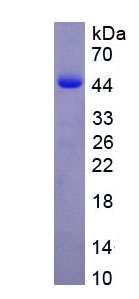 Active Interleukin 12B (IL12B)