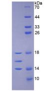 Active Interleukin 15 (IL15)