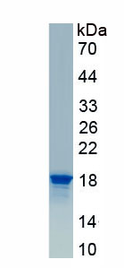 Active Interleukin 2 (IL2)