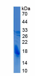 Active Interleukin 2 (IL2)