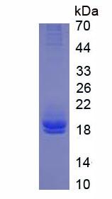 Active Interleukin 2 (IL2)