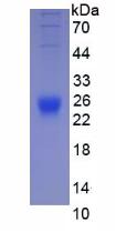 Active Interleukin 2 (IL2)