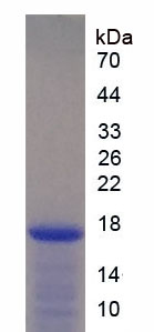 Active Interleukin 2 (IL2)