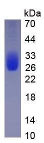 Active Interleukin 6 (IL6)