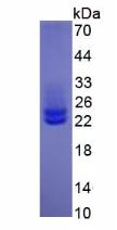 Active Interleukin 6 (IL6)