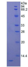 Active Interleukin 8 (IL8)