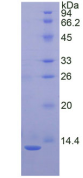 Active Interleukin 8 (IL8)