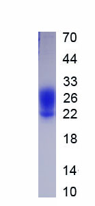 Active Monocyte Chemotactic Protein 1 (MCP1)