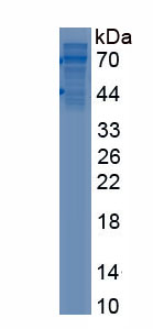 Active Colony Stimulating Factor 1, Macrophage (MCSF)