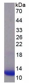 Active Macrophage Inflammatory Protein 1 Alpha (MIP1a)