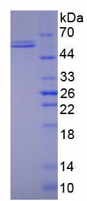 Active Matrix Metalloproteinase 1 (MMP1)