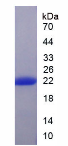 Active Matrix Metalloproteinase 13 (MMP13)