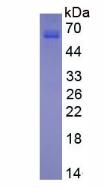 Active Matrix Metalloproteinase 13 (MMP13)