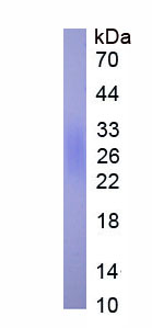 Active Placenta Growth Factor (PLGF)