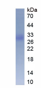 Active Superoxide Dismutase 3, Extracellular (SOD3)