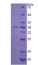 Active Superoxide Dismutase 3, Extracellular (SOD3)