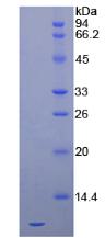 Active Stromal Cell Derived Factor 1 (SDF1)