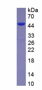 Active Transforming Growth Factor Beta 1 (TGFb1)