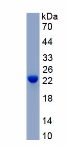 Active Tissue Inhibitors Of Metalloproteinase 2 (TIMP2)