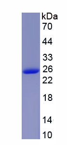 Active Tissue Inhibitors Of Metalloproteinase 3 (TIMP3)