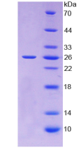 Active Tissue Inhibitors Of Metalloproteinase 3 (TIMP3)