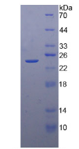 Active Tissue Inhibitors Of Metalloproteinase 4 (TIMP4)