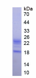 Active Tumor Necrosis Factor Alpha (TNFa)