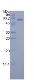 Active Adiponectin Receptor 1 (ADIPOR1)