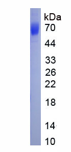 Active Alpha 2-Antiplasmin (a2PI)