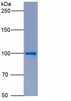 Active Galactosidase Beta (GLb)