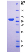 Active Ribonuclease P (RNASEP)