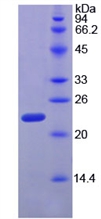 Active Ribonuclease P (RNASEP)