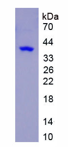 Active Triggering Receptor Expressed On Myeloid Cells 1 (TREM1)