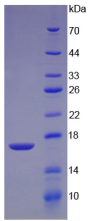 Active Transforming Growth Factor Beta 2 (TGFb2)