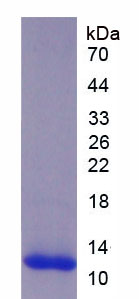 Active Transforming Growth Factor Beta 2 (TGFb2)