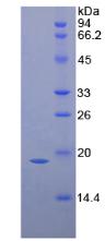 Active Interleukin 1 Receptor Antagonist (IL1RA)